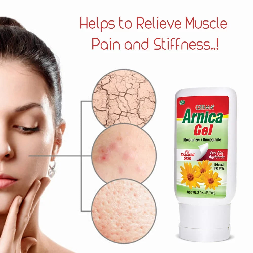 Analgesic. Germa Moisturizer Pack / Arthitis. 6 Topical for Natural Pain Arnica Skin. Cracked Ache of Gel. Relief Bruises and for 2 oz.