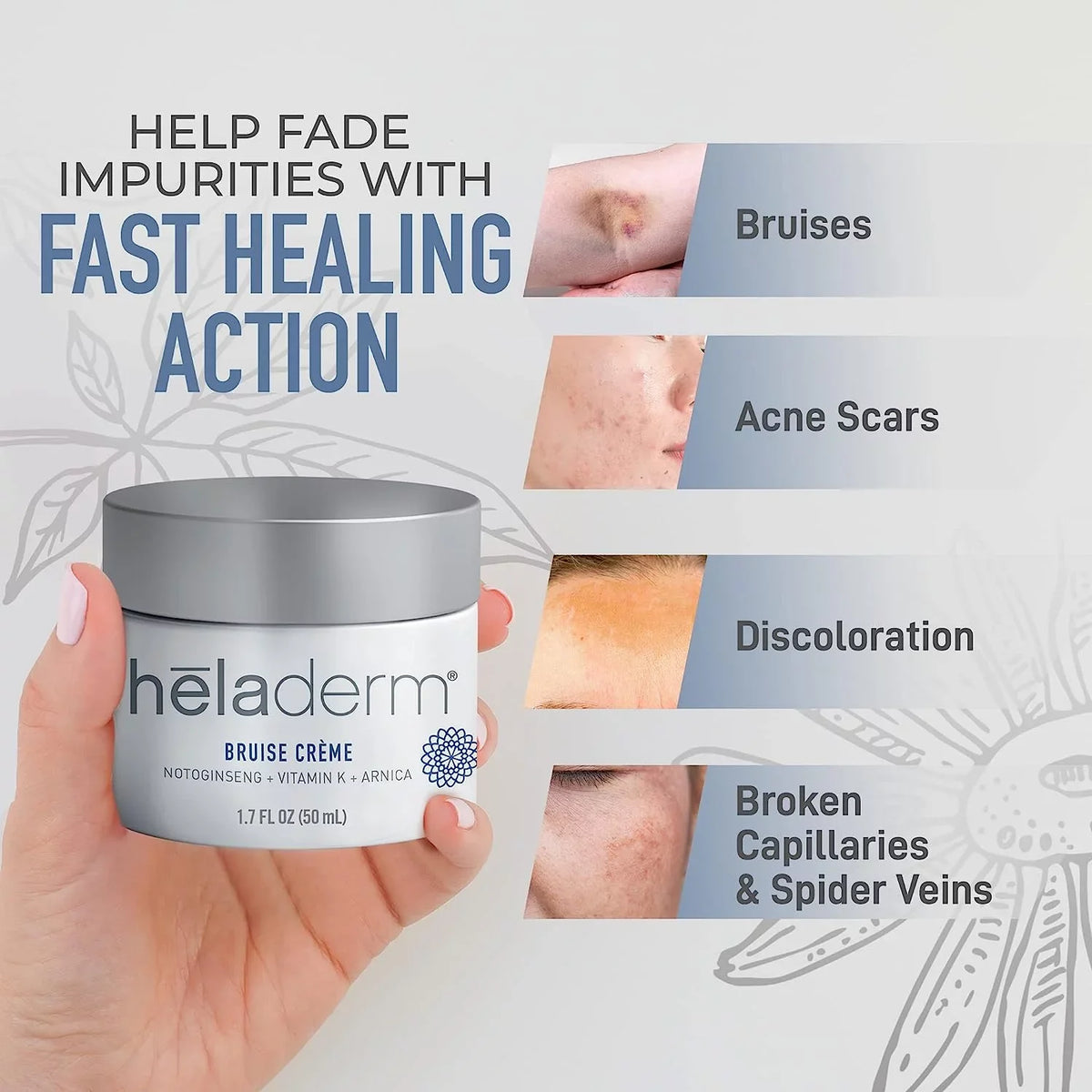Bruise Healing, Bruise Arnica 1.7 Cream, Swelling Rejuvenates Oil oz Skin, Fast and Skincare, Heladerm