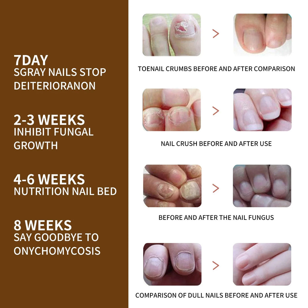 Nail Growth, Damaged Nail Serum, Nail Nails Nail 3PCS Growth for Growth Nail Strengthening for Reconstrux Serum, and Repair Healing Organic and Nail Serum, Deep Growth Growth Serum