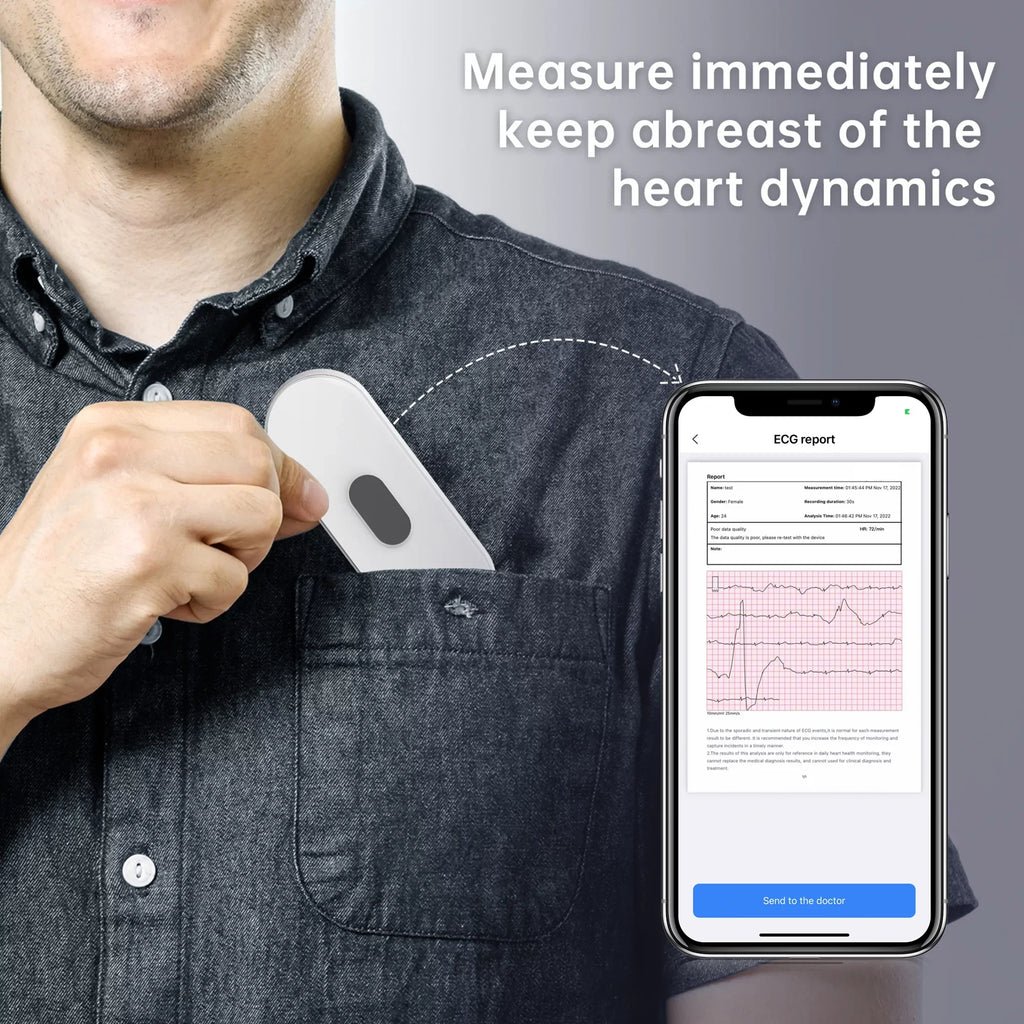 APP Wellue Measurement,Unlimited EKG Display,Handheld Monitor Screen Home with Heart with Storage Monitor Free Rate Tracker Personal Heart Bluetooth ECG Use,30s-5mins for