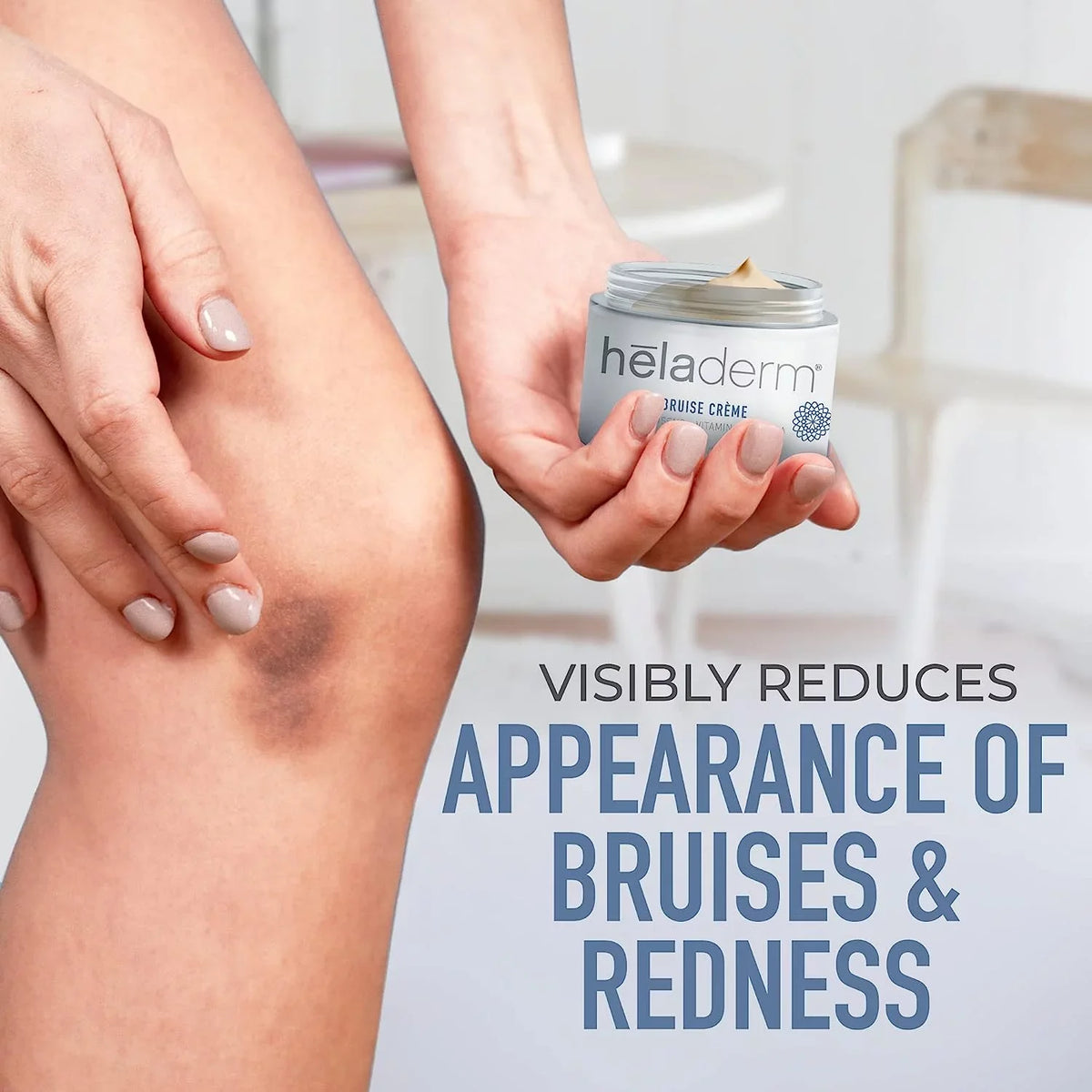 Bruise Healing, Bruise Arnica 1.7 Cream, Swelling Rejuvenates Oil oz Skin, Fast and Skincare, Heladerm