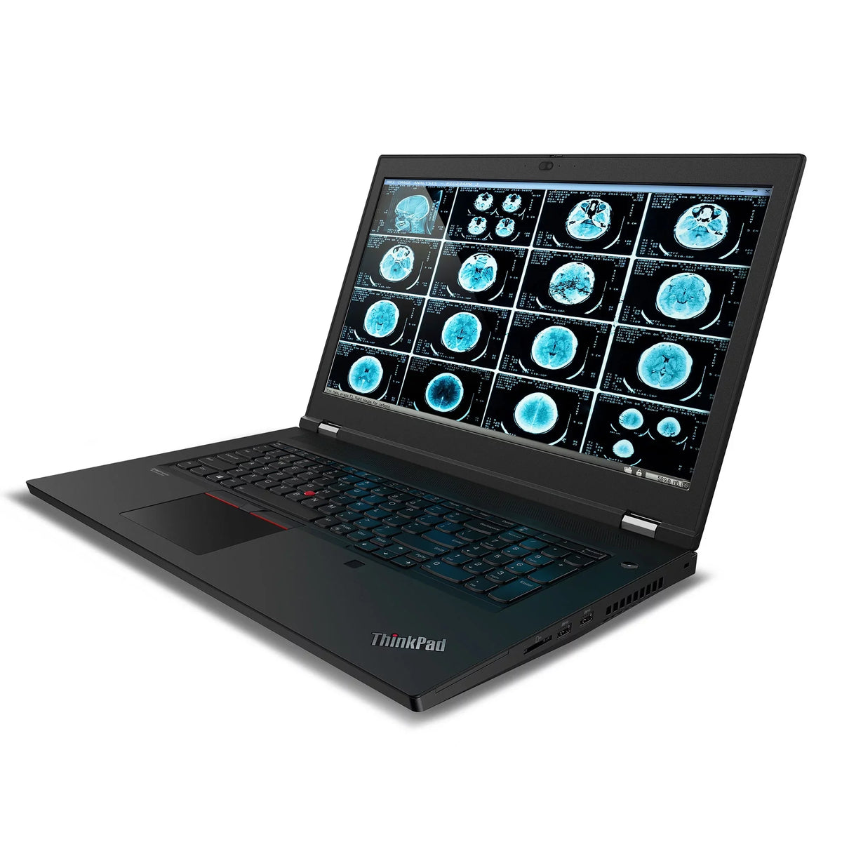 P17 Lenovo nits, 32GB, FHD Quadro, Laptop, 1TB ThinkPad 17.3" IPS 300 i7-10750H,