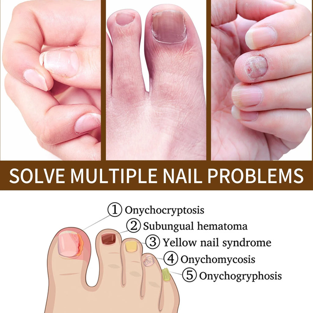 Nail Growth, Damaged Nail Serum, Nail Nails Nail 3PCS Growth for Growth Nail Strengthening for Reconstrux Serum, and Repair Healing Organic and Nail Serum, Deep Growth Growth Serum